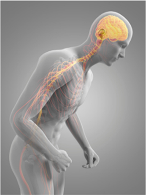 パーキンソン病、難病のトレーニングに長けたスタッフ